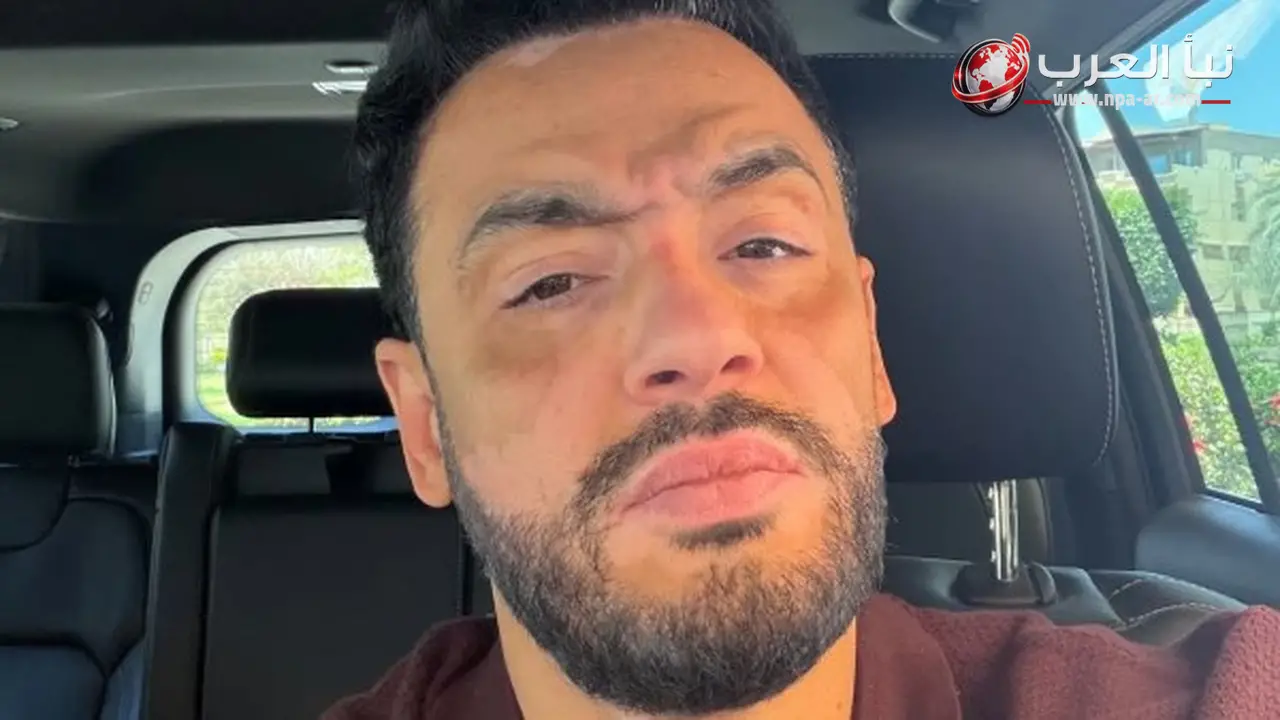 رامي جمال وسعد لمجرد يطلقان أغنية ليلة ورا ليلة ضمن ألبوم دي علامة
