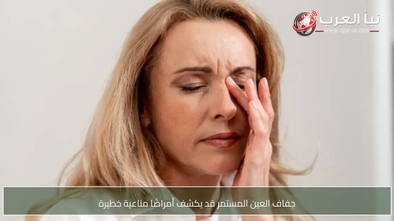 جفاف العين المستمر قد يكشف أمراضًا مناعية خطيرة