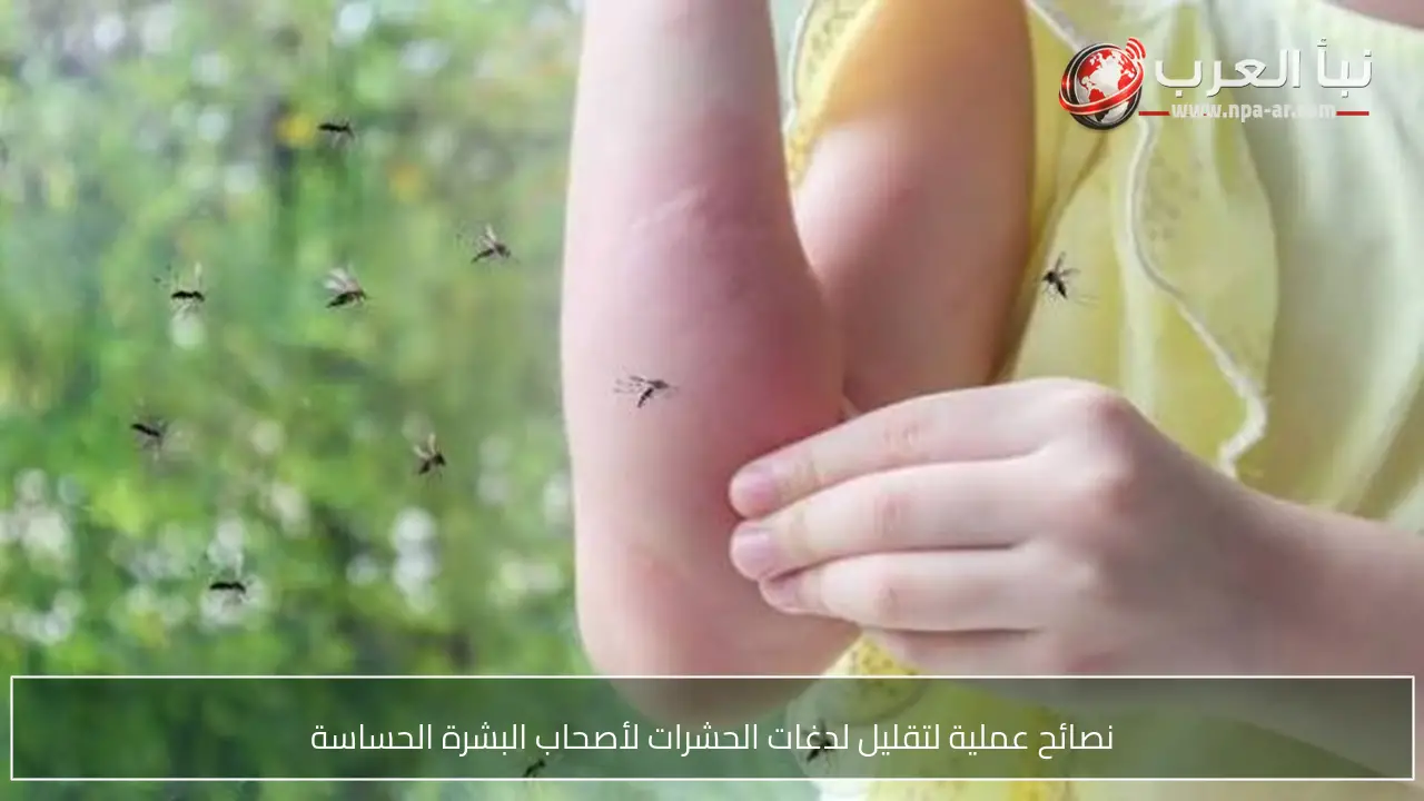 نصائح عملية لتقليل لدغات الحشرات لأصحاب البشرة الحساسة