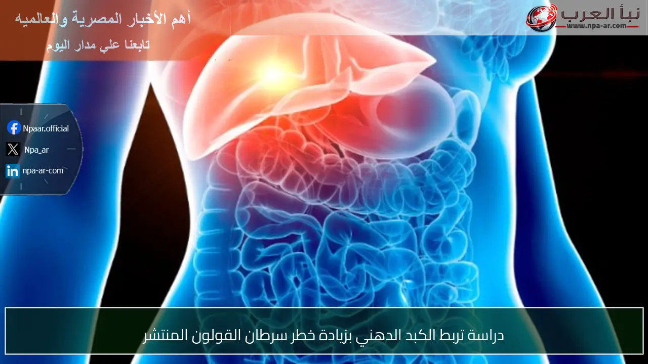 دراسة تربط الكبد الدهني بزيادة خطر سرطان القولون المنتشر
