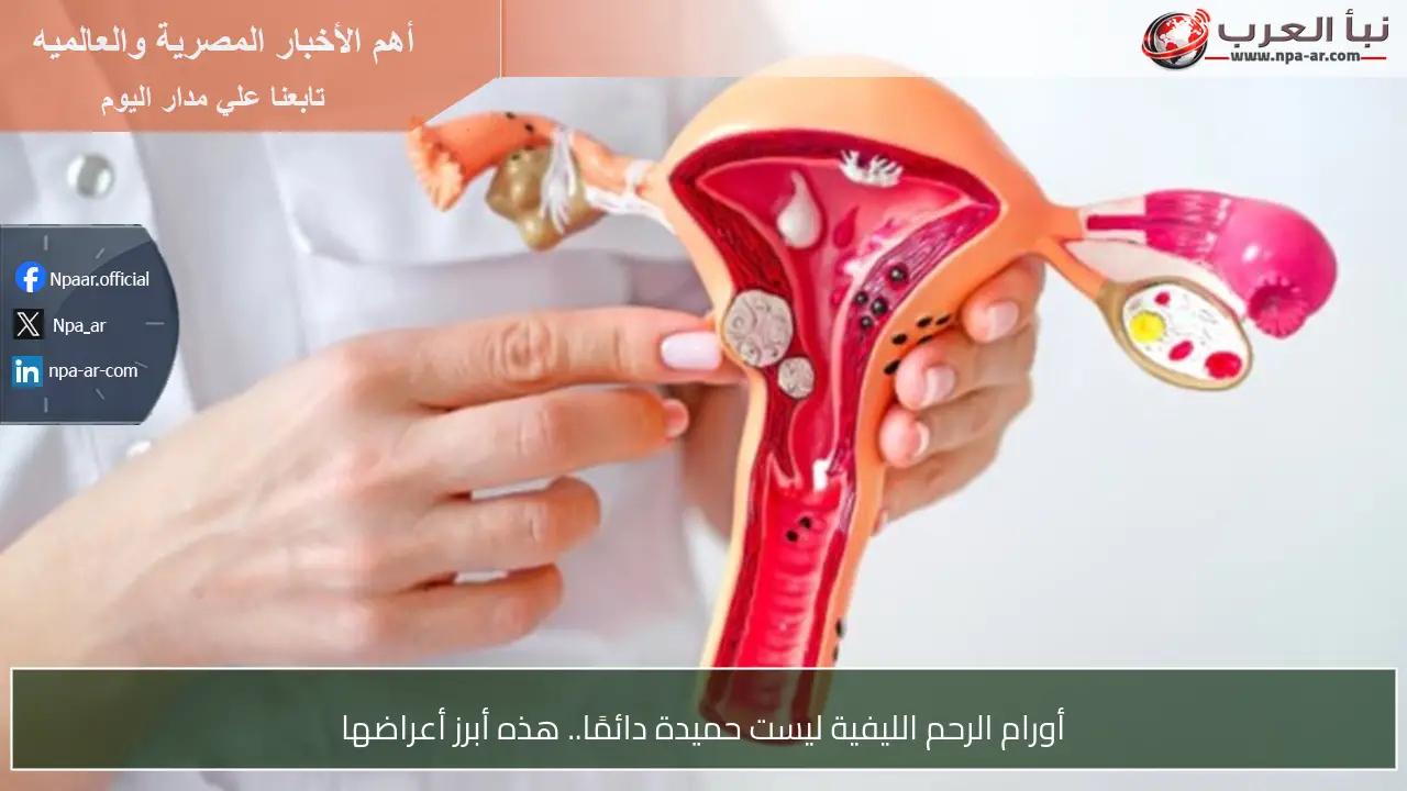 أورام الرحم الليفية ليست حميدة دائمًا.. هذه أبرز أعراضها