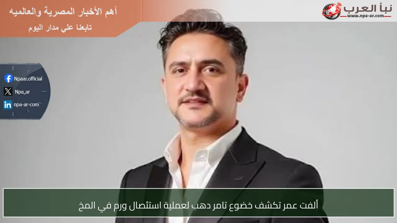 ألفت عمر تكشف خضوع تامر دهب لعملية استئصال ورم في المخ