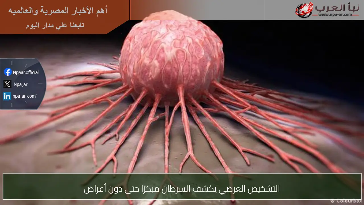 التشخيص العرضي يكشف السرطان مبكرًا حتى دون أعراض