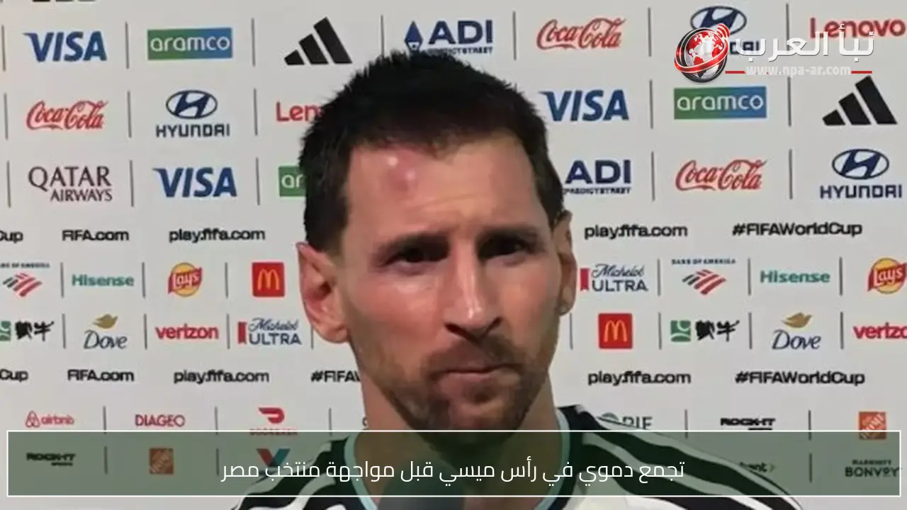 تجمع دموي في رأس ميسي قبل مواجهة منتخب مصر