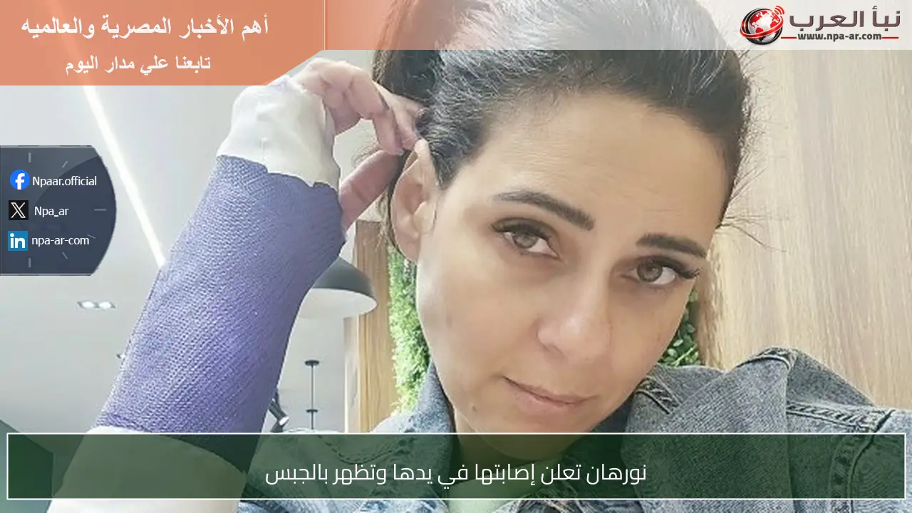 نورهان تعلن إصابتها في يدها وتظهر بالجبس