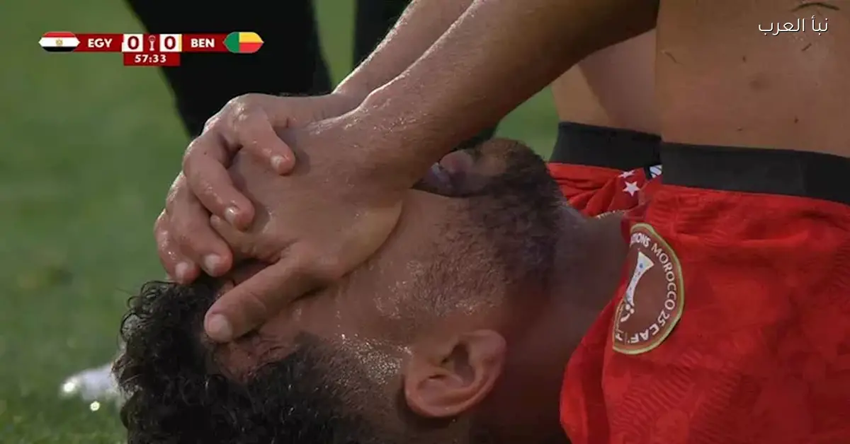 تريزيجيه يتعرض للإصابة ويغادر ملعب المباراة في 13 صورة توثق اللحظة