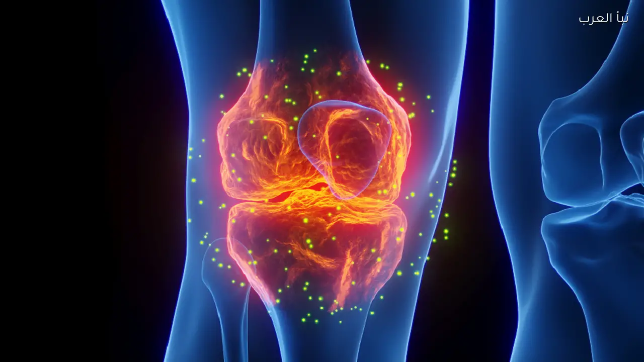 ابتكار جديد في ترميم العظام قد يغير مجرى العلاج