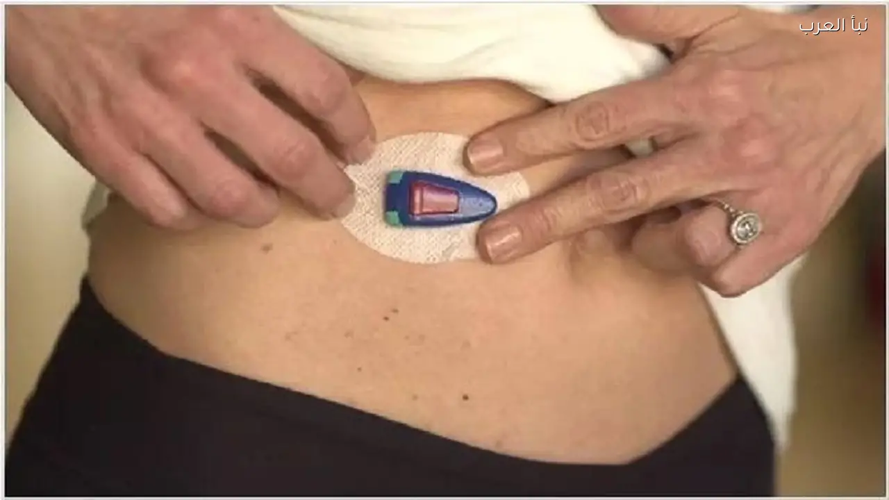 جهاز روسي جديد يقيس مستوى السكر في الدم دون وخز الجلد